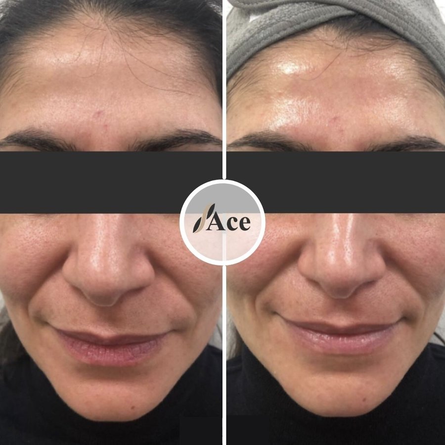 Ace Aesthetics - Ace Aesthetics